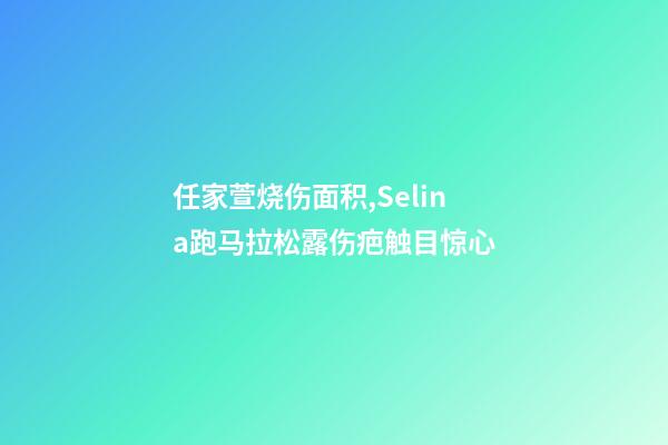任家萱烧伤面积,Selina跑马拉松露伤疤触目惊心-第1张-观点-玄机派