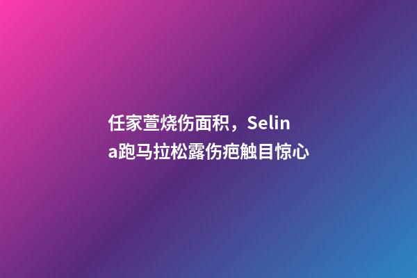 任家萱烧伤面积，Selina跑马拉松露伤疤触目惊心-第1张-观点-玄机派
