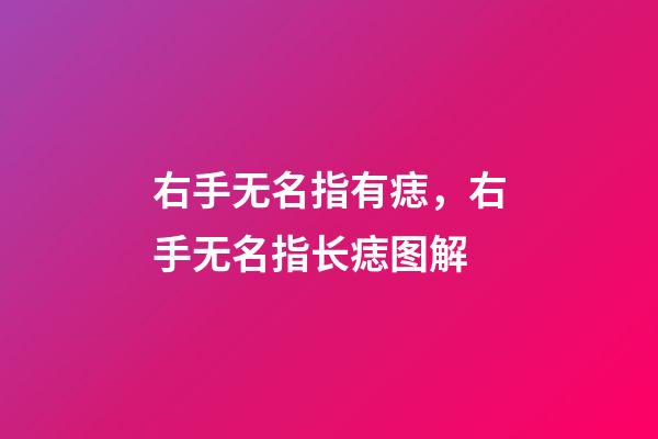 右手无名指有痣，右手无名指长痣图解