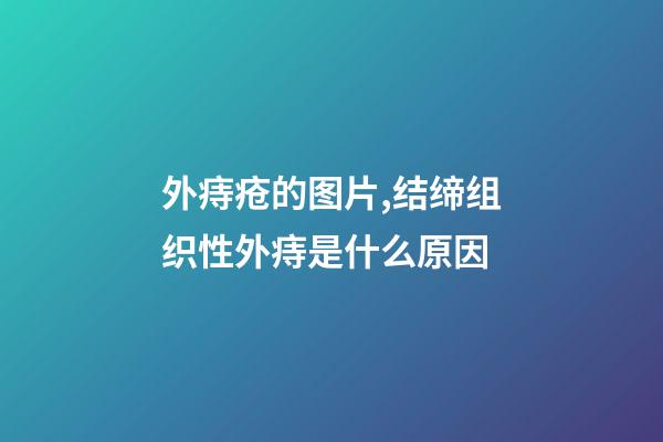 外痔疮的图片,结缔组织性外痔是什么原因-第1张-观点-玄机派