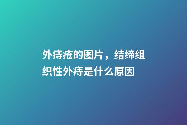 外痔疮的图片，结缔组织性外痔是什么原因-第1张-观点-玄机派