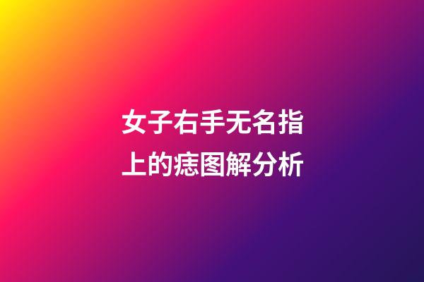 女子右手无名指上的痣图解分析