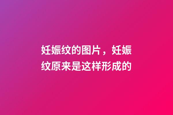 妊娠纹的图片，妊娠纹原来是这样形成的-第1张-观点-玄机派