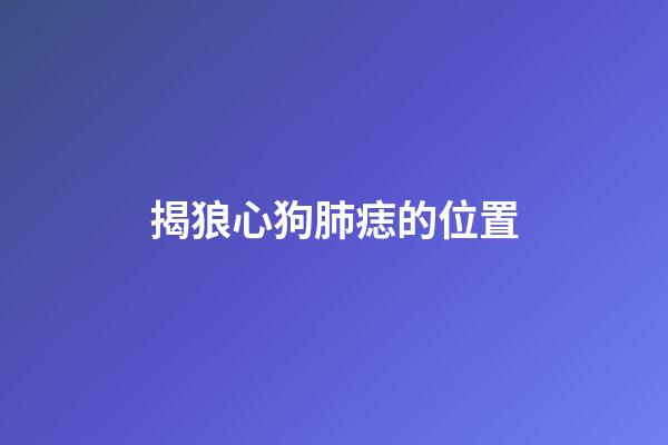 揭狼心狗肺痣的位置