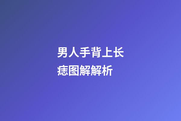 男人手背上长痣图解解析