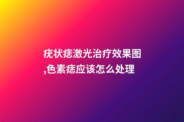 疣状痣激光治疗效果图,色素痣应该怎么处理-第1张-观点-玄机派