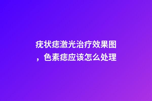疣状痣激光治疗效果图，色素痣应该怎么处理-第1张-观点-玄机派