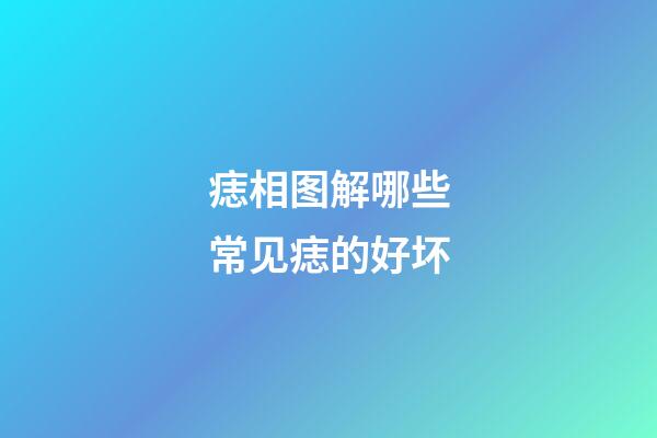 痣相图解哪些常见痣的好坏