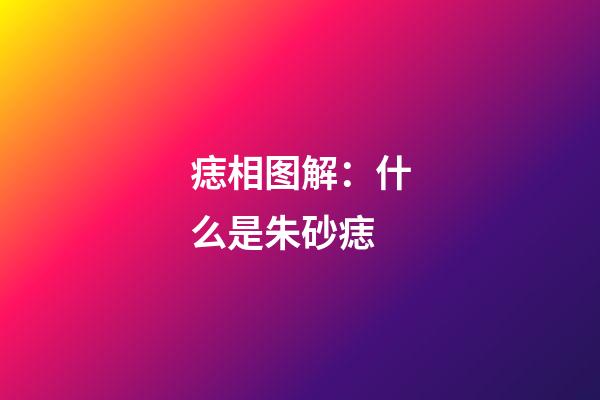 痣相图解：什么是朱砂痣