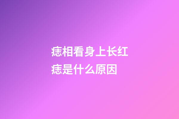 痣相看身上长红痣是什么原因
