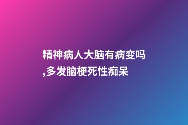 精神病人大脑有病变吗,多发脑梗死性痴呆-第1张-观点-玄机派