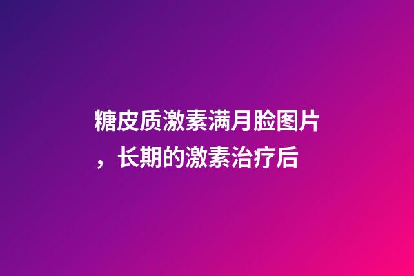 糖皮质激素满月脸图片，长期的激素治疗后-第1张-观点-玄机派