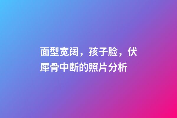 面型宽阔，孩子脸，伏犀骨中断的照片分析